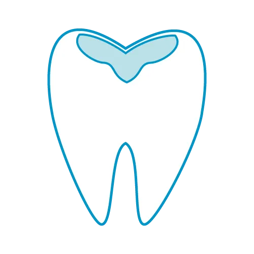 虫歯・歯周病の方